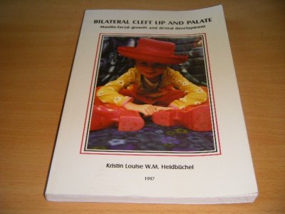 Tweedehands boek: Bilateral cleft lip and palate van auteur Kristin Louise W.M. Heidbuchel - Paperback, met leesvouw, naam op titelblad, in goede staat.